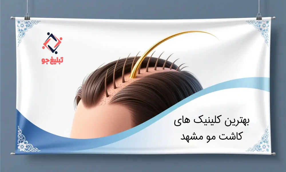 ۵ کلینیک کاشت مو مشهد