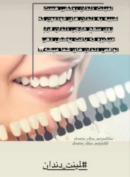 بهترین لابراتور دندانسازی در مشهد – لابراتوار دندانسازی دنت ایران در مشهد
